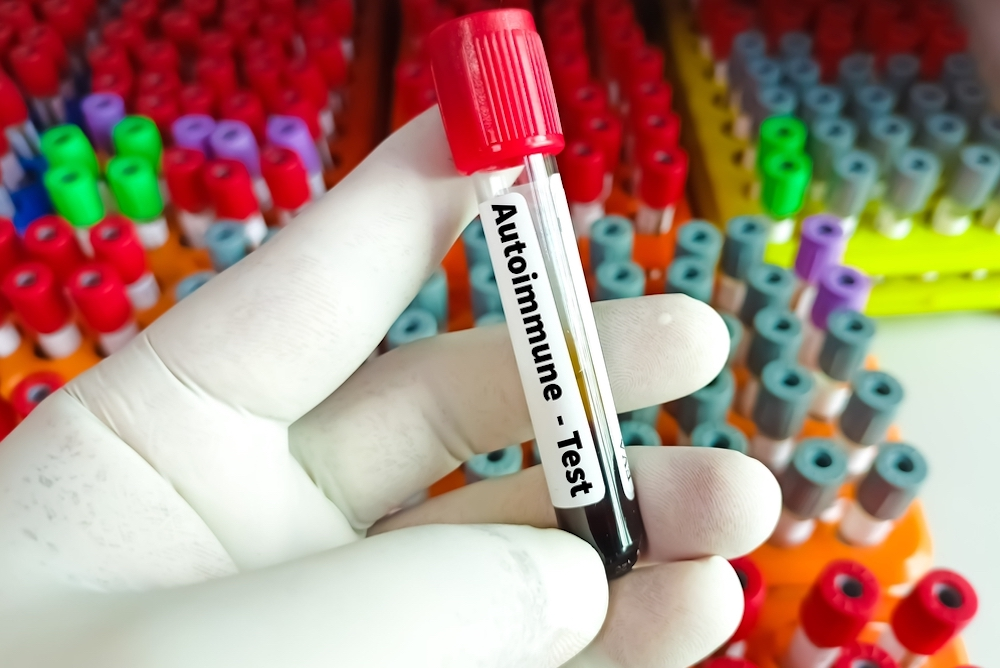 autoimmune test tube